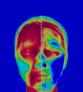 Kiểm tra tác động của tia UV (nhiệt) lên da và hiệu quả cải thiện làn da thông qua khả năng bảo vệ khỏi tia UV (nhiệt).