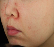 Sau 3 ngày sử dụng sản phẩm